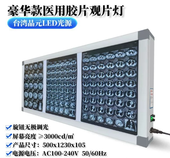 汉魏康三联观片灯  灯管款阅片机骨科X光片读片灯牙科多联观片灯箱